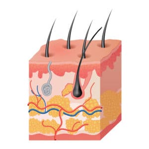 Laser Hair Removal Austin TX