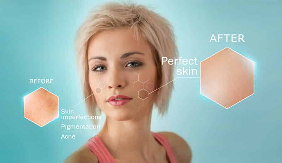 BBL Photofacial Treatment Austin TX