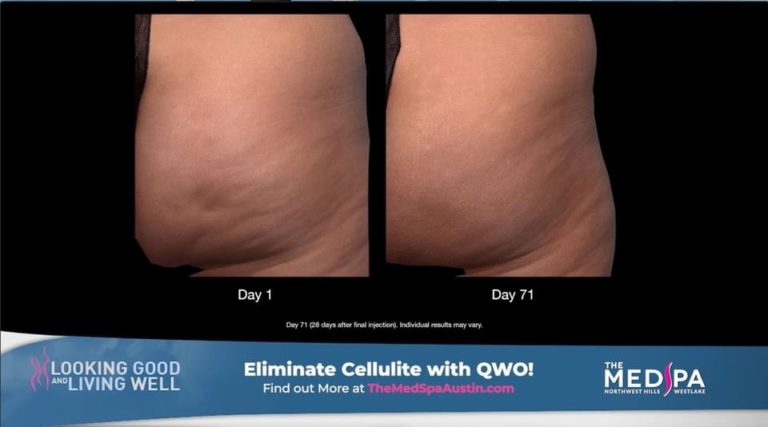 Before and After 768x427 1