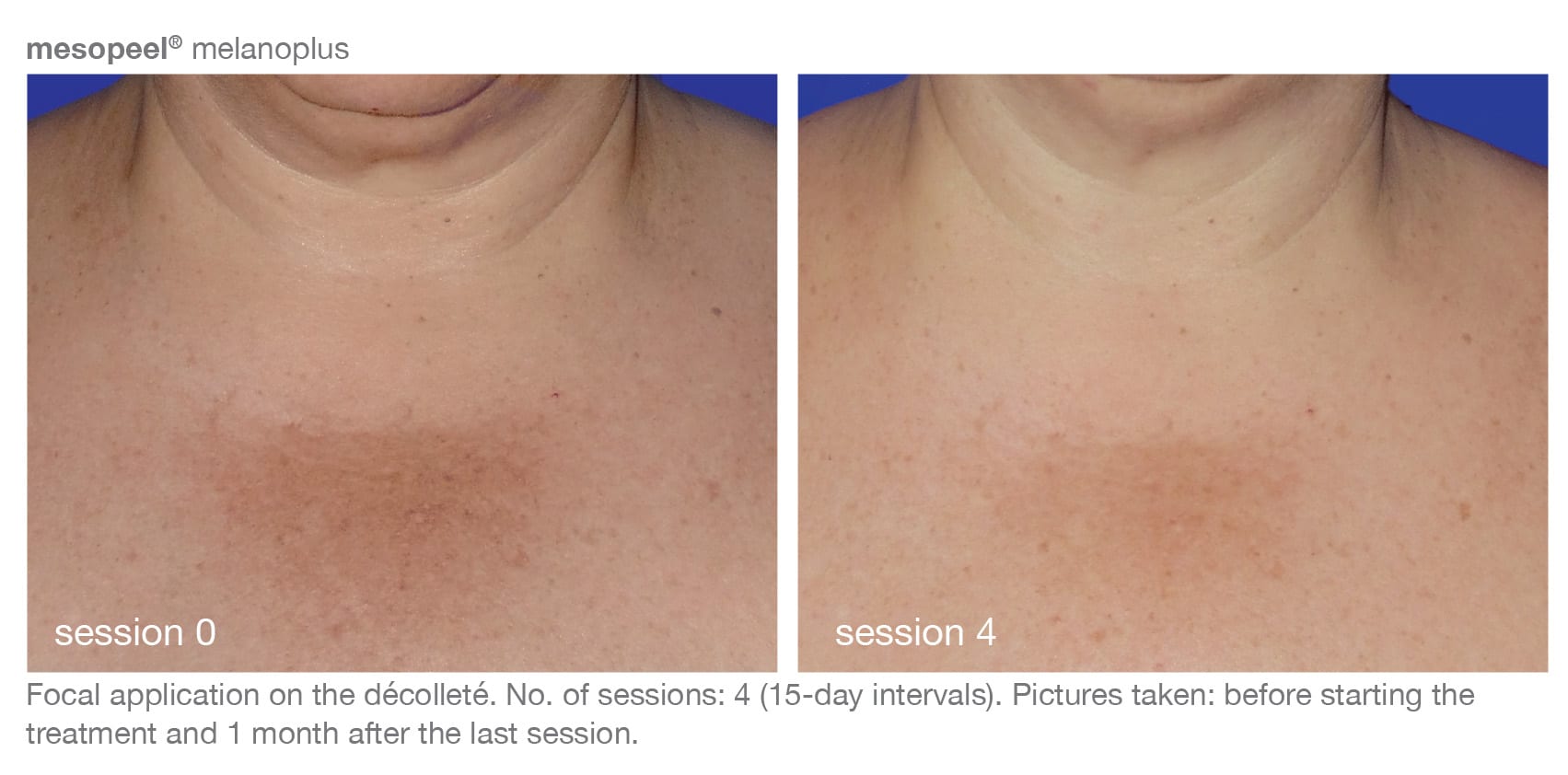 Before and After Image of Skin Care Products Austin TX