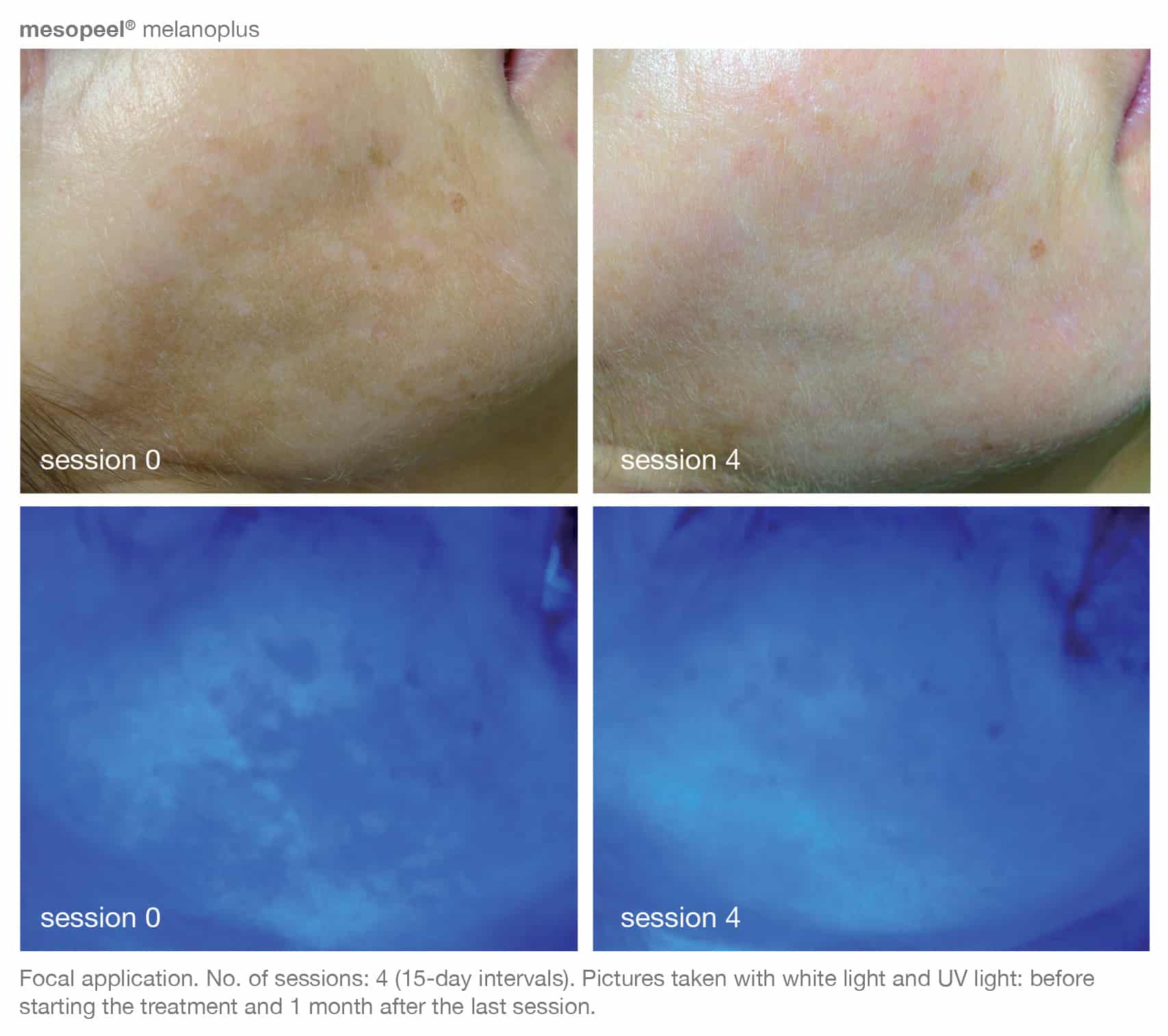 Before and After Image of Skin Care Products Westlake TX