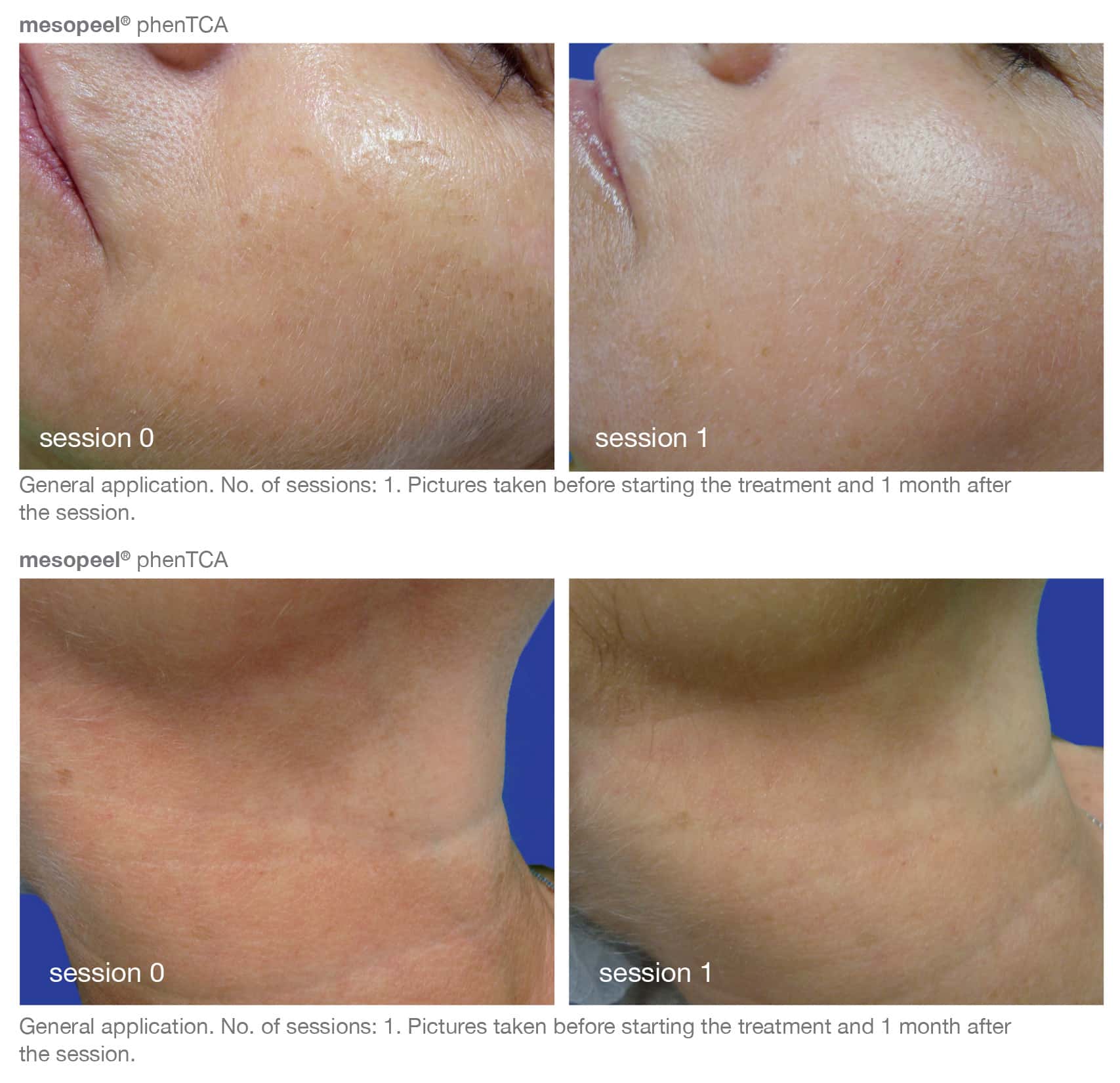 Before and After Image of Skincare Treatment Westlake TX