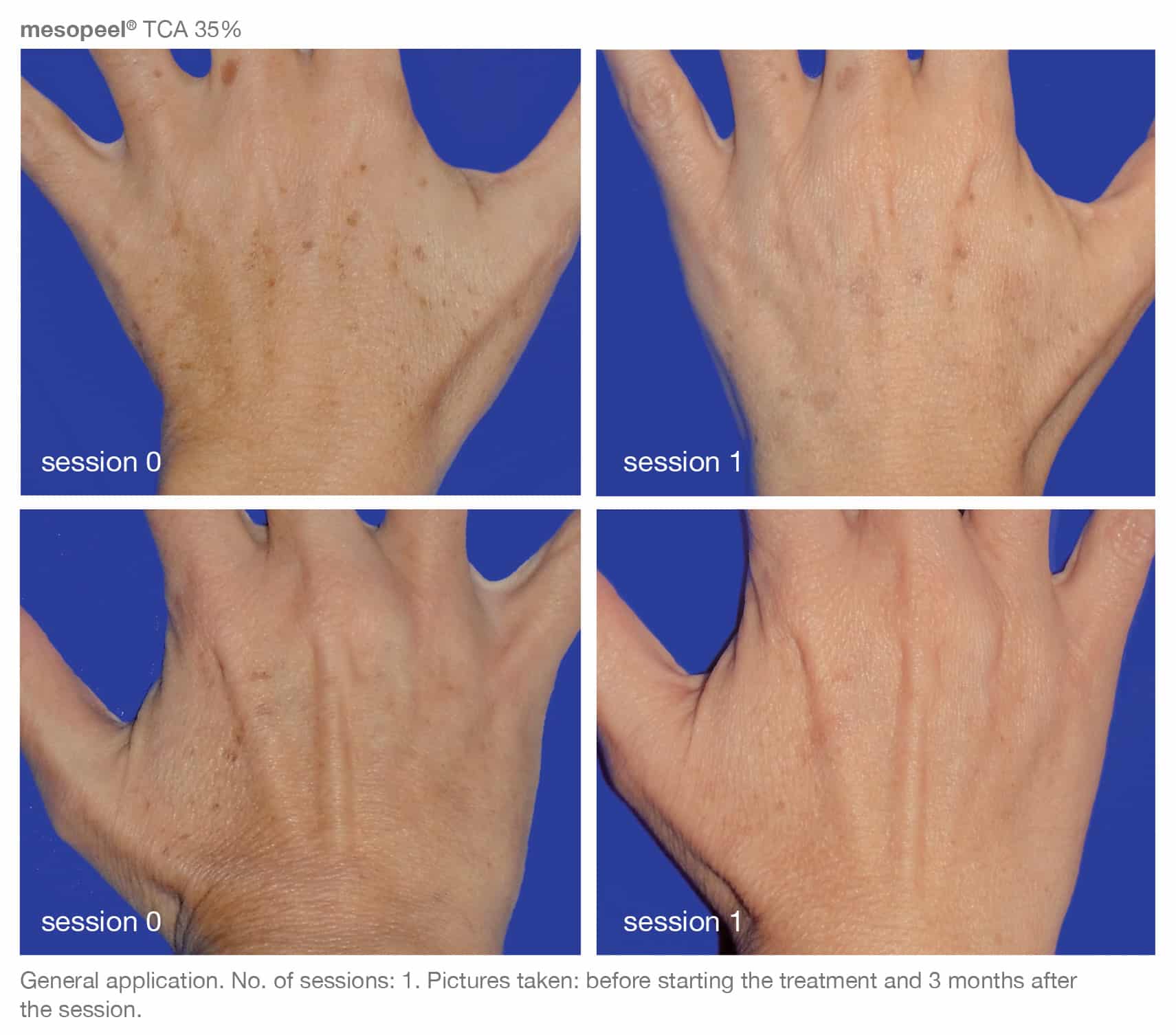 Before and After Image of Medical-grade skincare Westlake TX