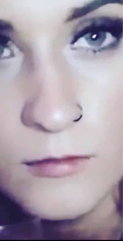 Before Image: Cosmetic Filler – Lips - front