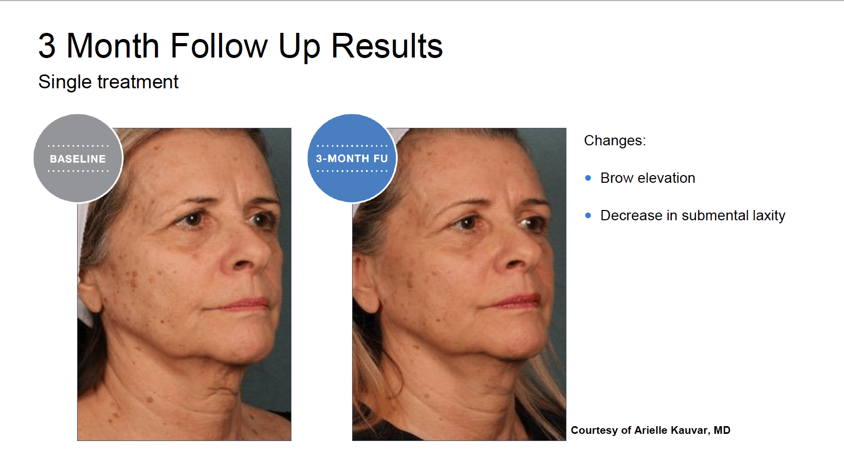 Screen Shot 2022 04 17 at 6.03.05 PM