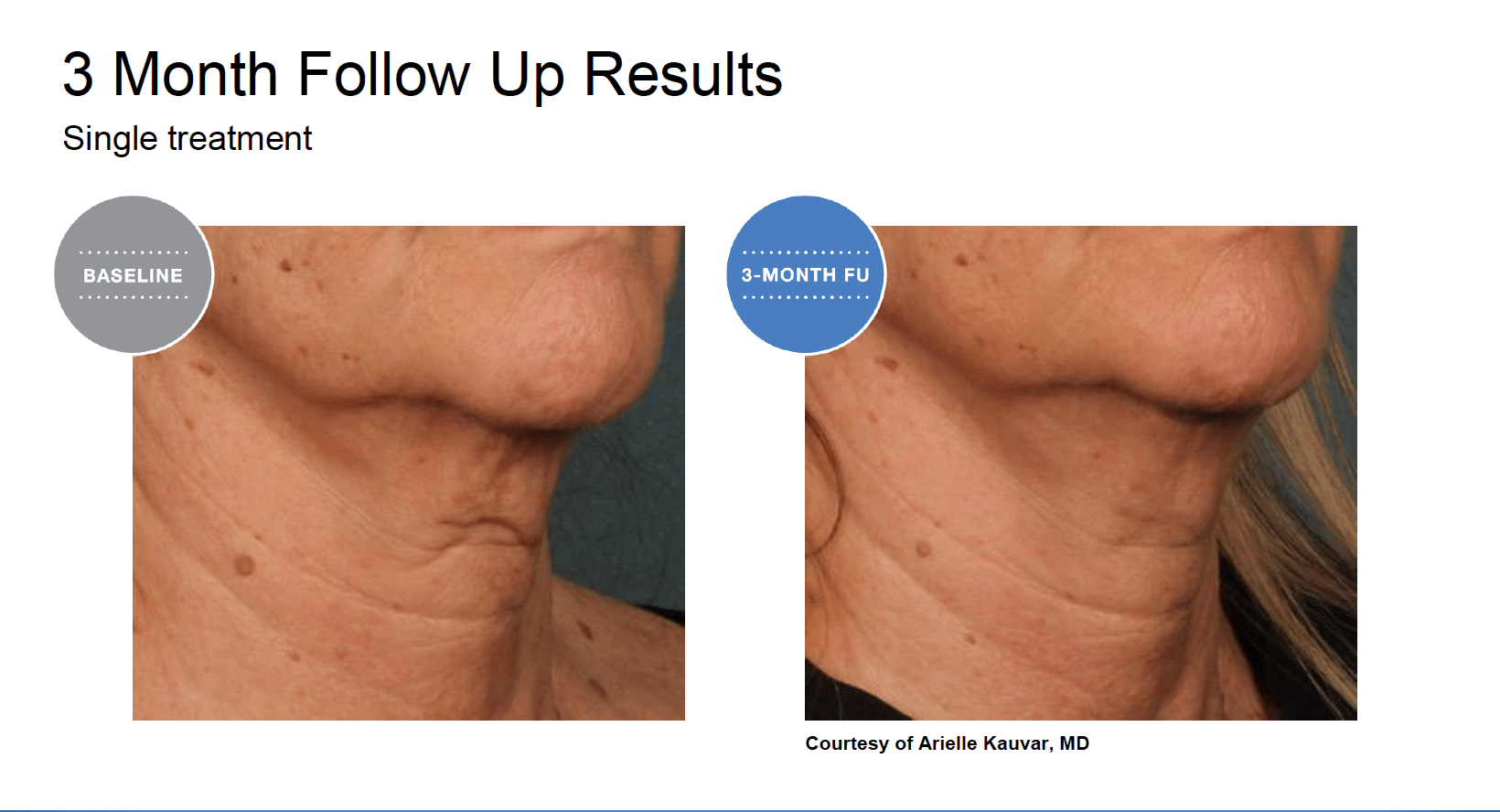 Screen Shot 2022 04 17 at 6.03.14 PM