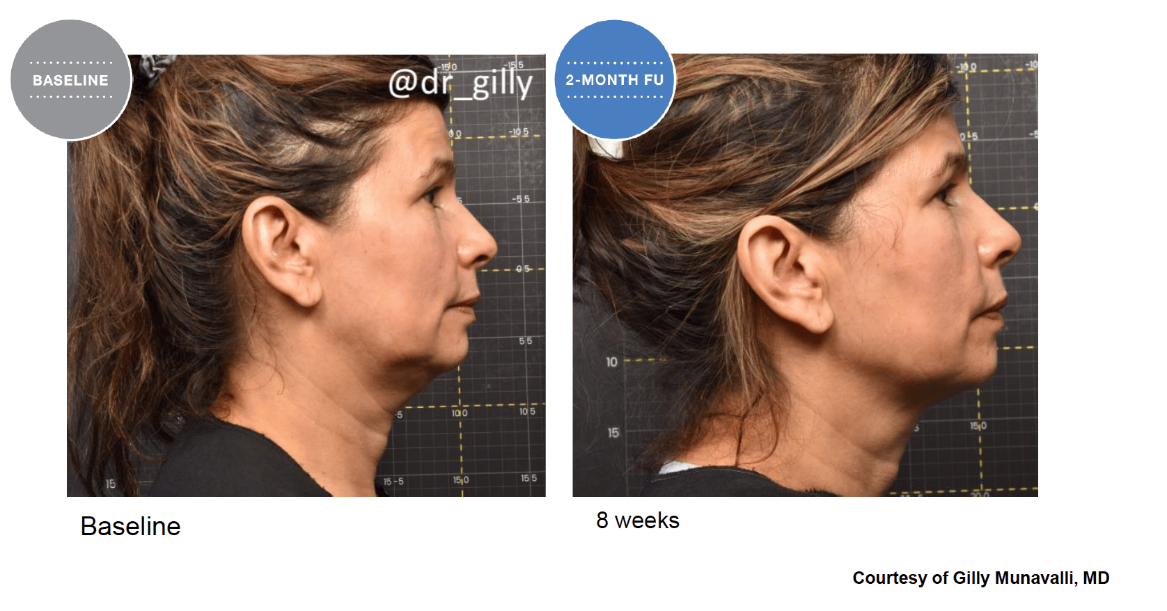 Screen Shot 2022 04 17 at 6.03.50 PM