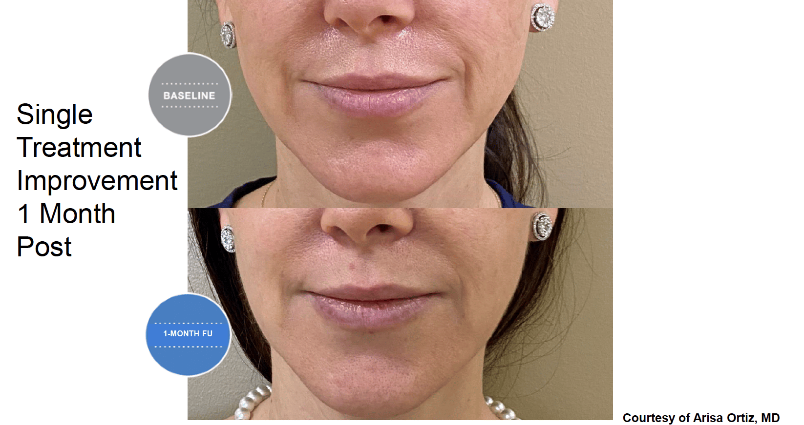 Screen Shot 2022 04 17 at 6.04.15 PM