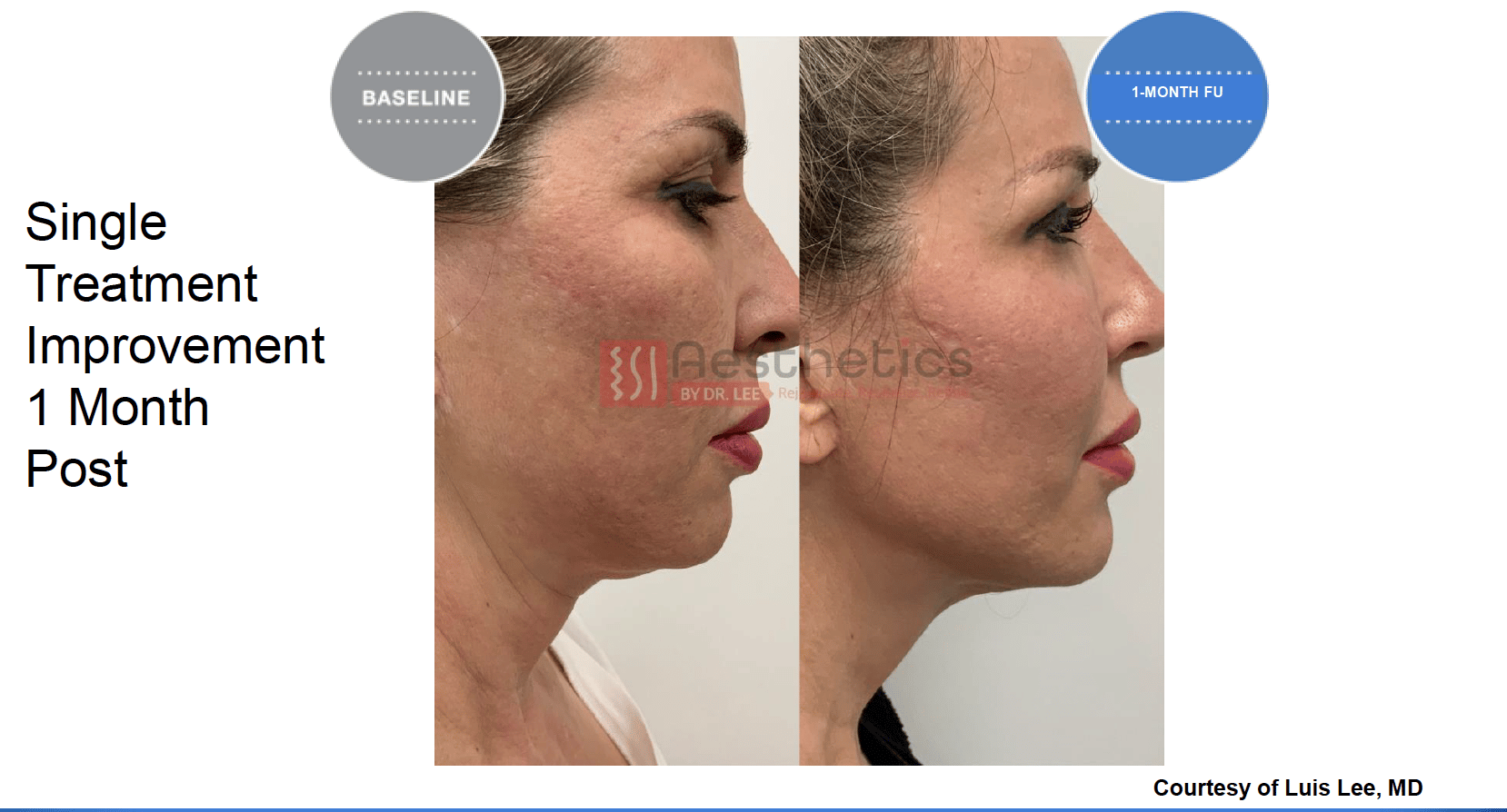 Screen Shot 2022 04 17 at 6.04.23 PM