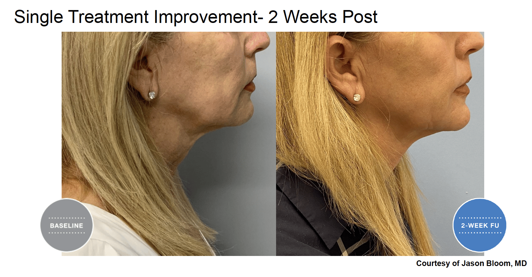 Screen Shot 2022 04 17 at 6.04.39 PM