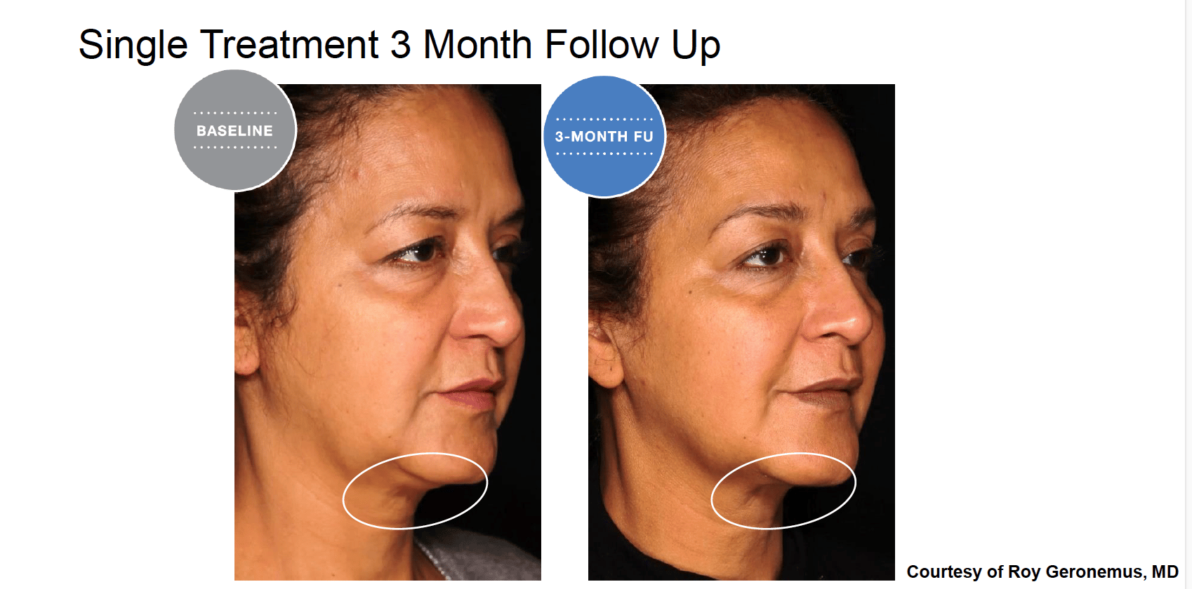 Screen Shot 2022 04 17 at 6.05.10 PM