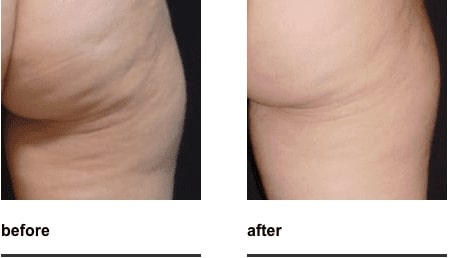 Before & After Image of Z-Wave Austin TX