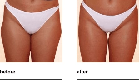 Before & After Image of Z-Wave Westlake TX