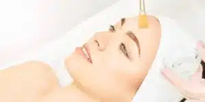 chemical peels